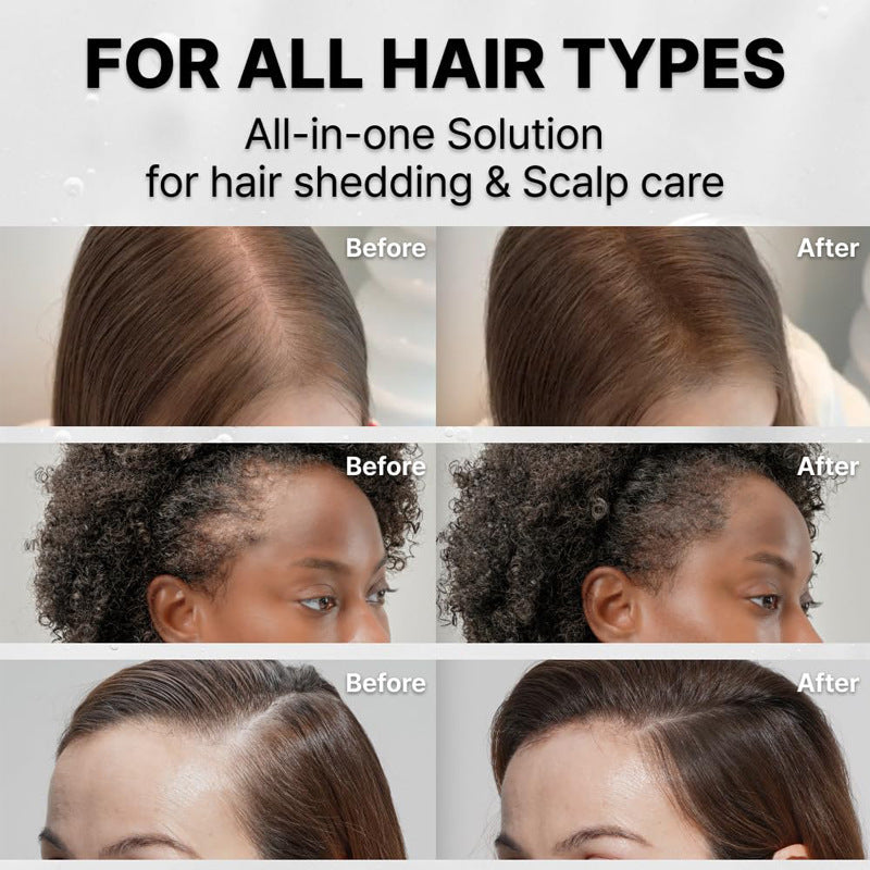 Hair Growth Serum with Brush-Head Applicator